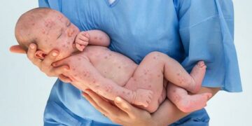 Los grandes desafíos de la OMS en el Día Mundial de la Salud