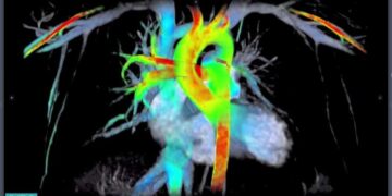 Así se ve el corazón en siete dimensiones
