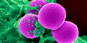 Argentina toma medidas para controlar a las superbacterias