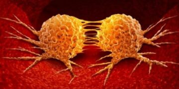 Desarrollan una nueva técnica para bloquear la metástasis