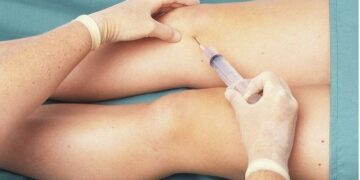 Crean una droga que regenera los cartílagos de las rodillas