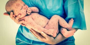 Movimientos antivacunas: cómo surgieron y por qué crecen