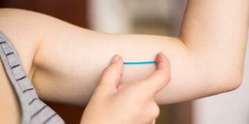 La Municipalidad entregará implantes anticonceptivos gratuitos