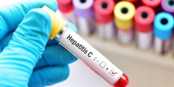 Estas son las actividades por el Día mundial de las Hepatitis