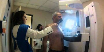 Cáncer de mama: los varones también deben hacerse chequeos