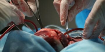 La cifra de donantes se acerca al promedio mundial