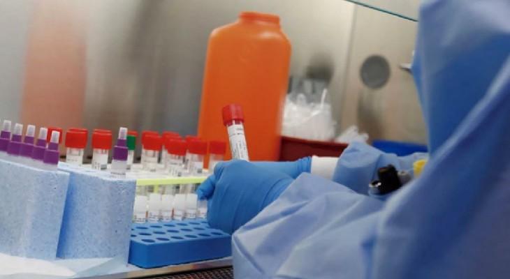 El Laboratorio Central de Córdoba ya realiza análisis de coronavirus