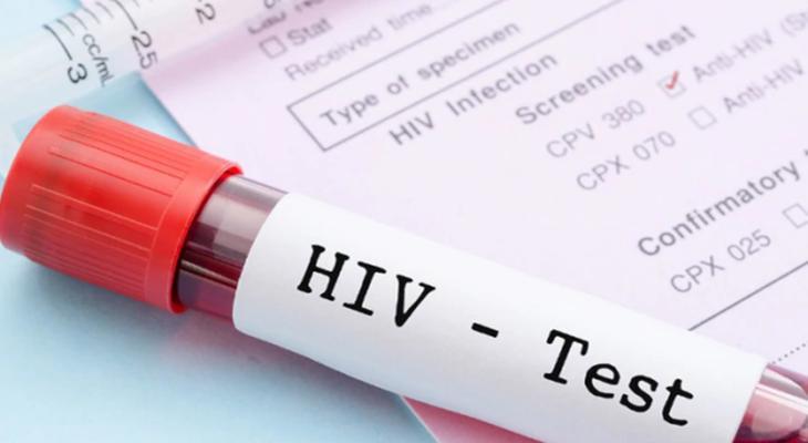 Recomienda a las personas con VIH no interrumpir el tratamiento