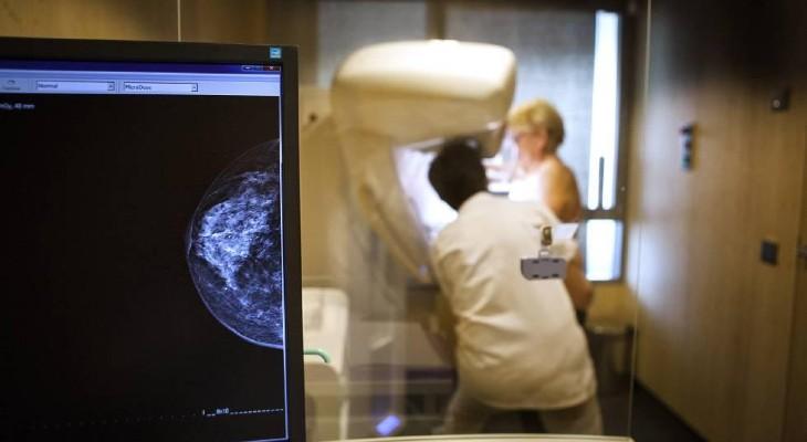 Entre un 40% y un 70% de mujeres no se hicieron la mamografía anual