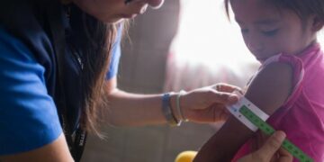 Distribuyen en Argentina una cinta que mide la malnutrición en niños