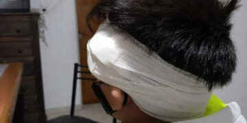 Un motociclista se fugó tras atropellar a un niño en Córdoba