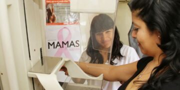 Apross ofrecerá mamografías sin coseguros durante octubre y noviembre