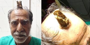 Le creció un cuerno de 10 centímetros en medio de la cabeza