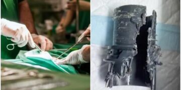 Se agrandó el pene, quiso comprobar el nuevo tamaño con un tubo y se le quedó atascado