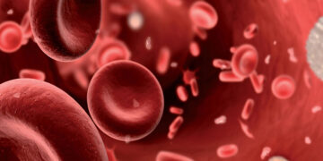 La trombofilia, el trastorno silencioso que afecta a hombres y mujeres