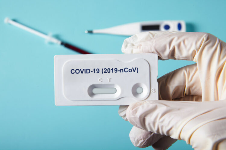 La Provincia sumaría autotests para detectar casos de Covid-19