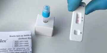 Venden kits para contagiarse con coronavirus