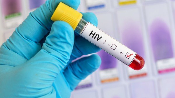 Existen casos de personas que se “curaron” solas del VIH. ¿Cómo sucede?