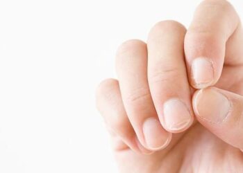 Las uñas pueden advertirnos sobre algunas enfermedades: cuáles son esos signos