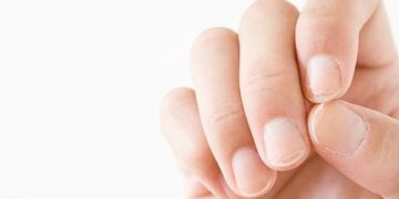 Las uñas pueden advertirnos sobre algunas enfermedades: cuáles son esos signos