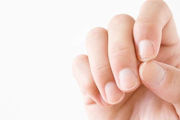 Las uñas pueden advertirnos sobre algunas enfermedades: cuáles son esos signos