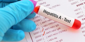 Un estudio argentino fue un crucial aporte a la estrategia de vacunación contra la hepatitis A