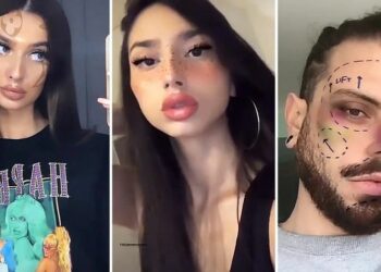 Cómo las redes sociales influyeron en el aumento de cirugías estéticas en jóvenes