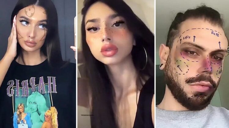 Cómo las redes sociales influyeron en el aumento de cirugías estéticas en jóvenes