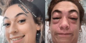 Se puso pestañas postizas y descubrió una nueva alergia