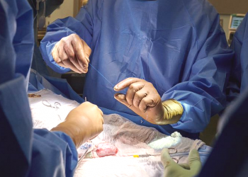 Realizaron el primer trasplante de dos riñones de un cerdo a un humano