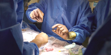 Realizaron el primer trasplante de dos riñones de un cerdo a un humano