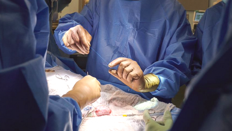Realizaron el primer trasplante de dos riñones de un cerdo a un humano