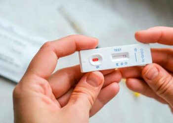 Bioquímicos afirman que los autotest de Covid-19 “no tienen valor de diagnóstico”