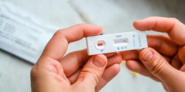 Bioquímicos afirman que los autotest de Covid-19 “no tienen valor de diagnóstico”