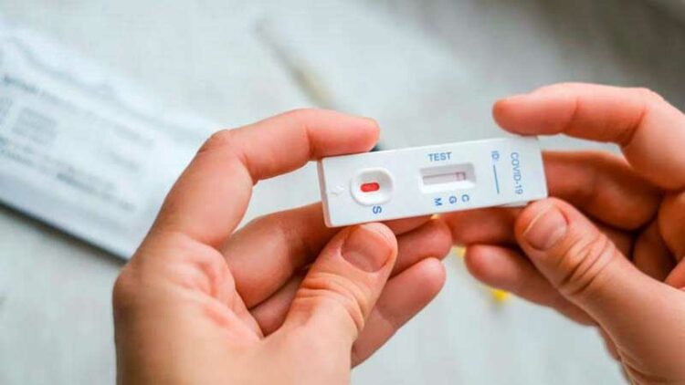 Bioquímicos afirman que los autotest de Covid-19 “no tienen valor de diagnóstico”
