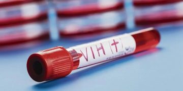 Identifican una variante de VIH más virulenta que surgió en Países Bajos