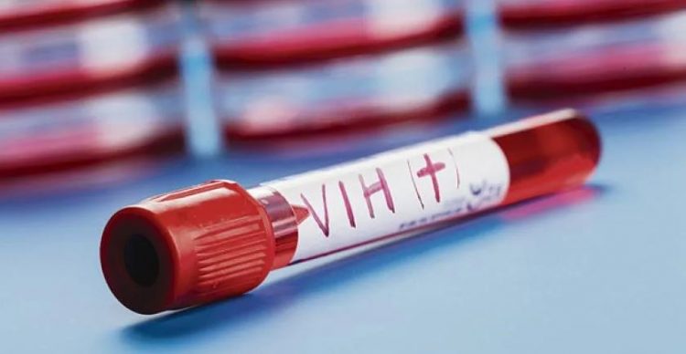 Identifican una variante de VIH más virulenta que surgió en Países Bajos