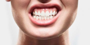 Óptimos consejos para mejorar el bruxismo