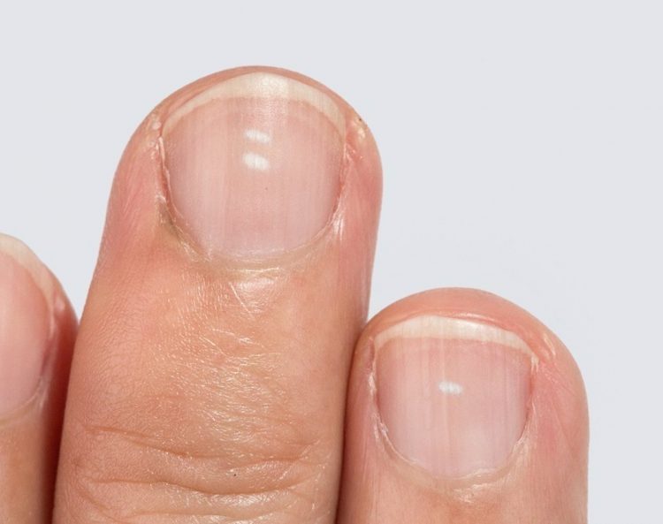 10/03/2017 White spots on fingernails
ESPAÑA EUROPA MADRID SALUD
GETTY