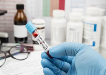 Están bajo estudio e investigación ocho casos sospechosos de hepatitis graves