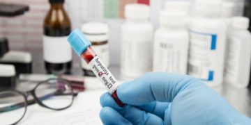 Están bajo estudio e investigación ocho casos sospechosos de hepatitis graves