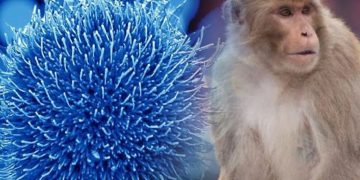 Cómo evoluciona el paciente con sospecha de tener la viruela del mono