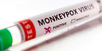 Viruela del mono: la OMS eliminó la distinción entre países endémicos y no endémicos