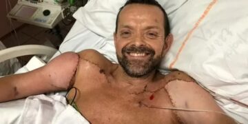 Luego de 20 años pudo abrazar a su familia tras recibir un trasplante de brazos