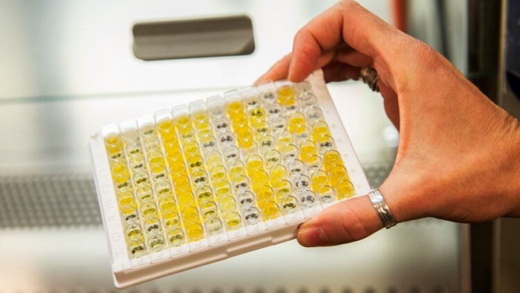 The Lancet destacó un estudio sobre Sinopharm realizado por el PAMI y el Conicet