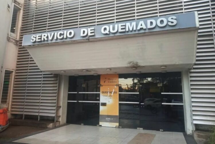Por la explosión de una salamandra, un niño de 7 años sufrió quemaduras en gran parte de su cuerpo