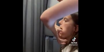 Bostezó tan fuerte que se le salió la mandíbula de lugar