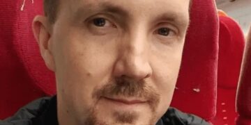 Asegura que le apareció el rostro de Jesús en un moretón