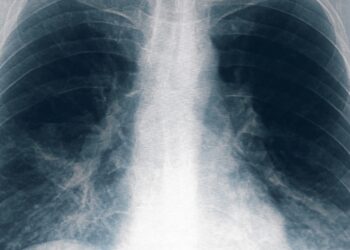 Legionella: se sumaron 8 nuevos casos en Tucumán