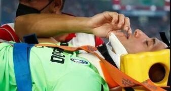 Musso fue operado de la fractura en el maxilar derecho